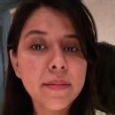 Alka photo